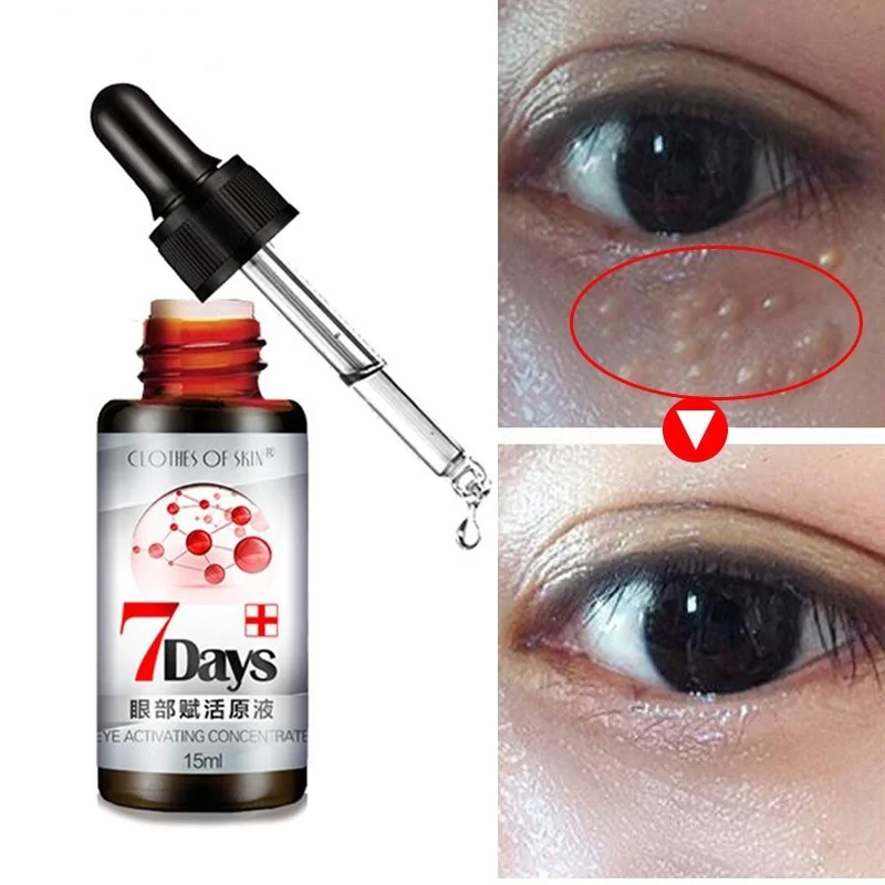 

15ml Reduced Fat Granules Eye Serum Remove Dark Circle Improve Eye Bag Easily Absorbed Anti-Puffiness Anti Wrinkle Eye Care