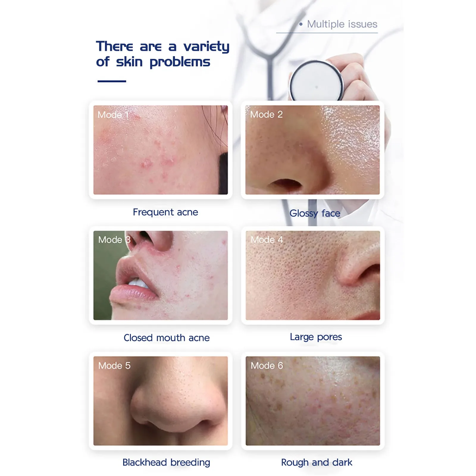 

Salicylic acid ice cream mask Purifying Stick Mask Oil Control Face Mask Stick Deep Cleansing Anti-Acne Skin Care Whitening Care