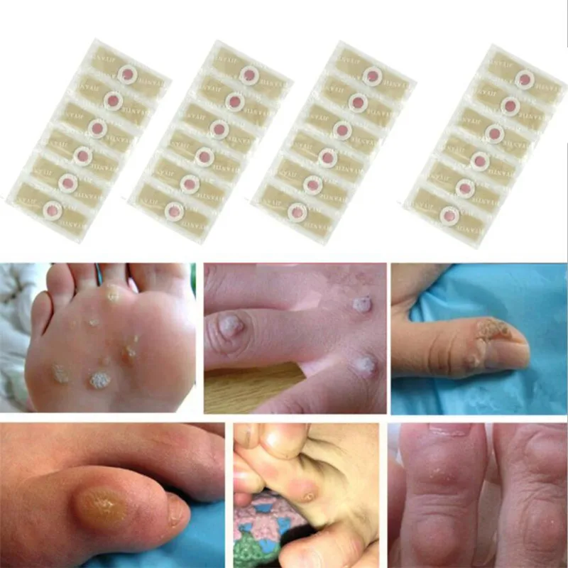 

48pcs Foot Care Stickers Medical Plaster Chicken Eye Corns Patches Medical Plaster Foot Corn Removal foot protector tool