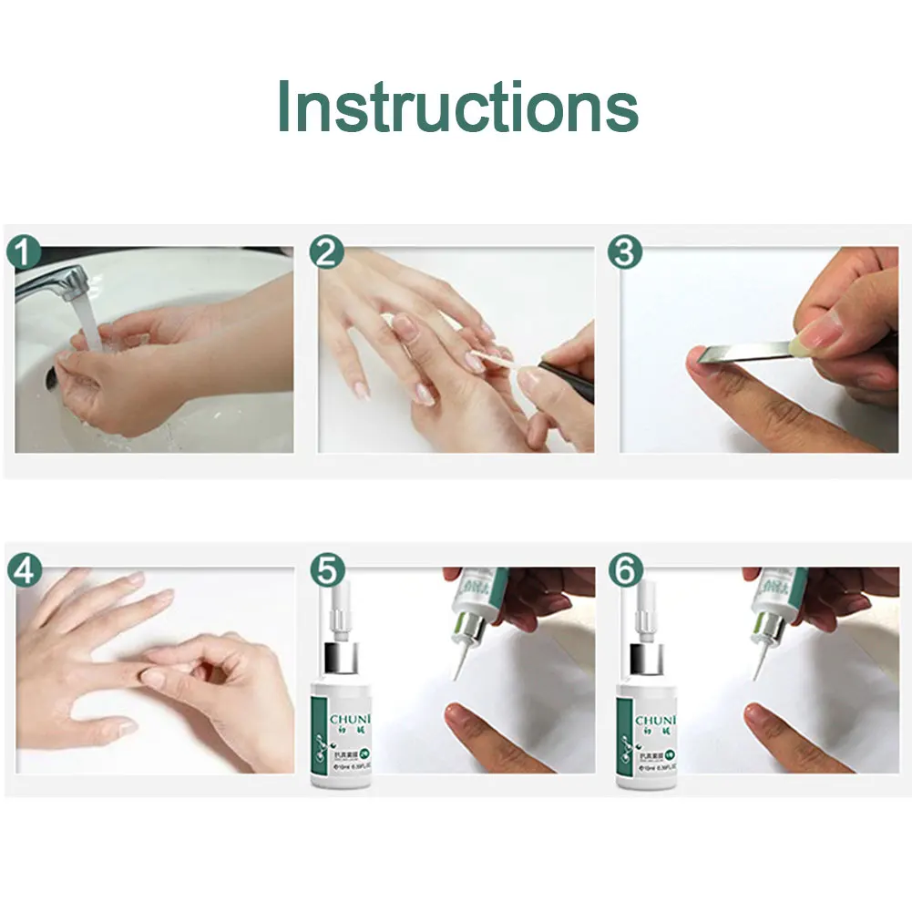 20 мл Ringworm Портативный Клей для ремонта ногтей ускоряет лечение роста Relustering