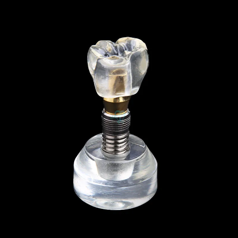 Новая модель зубных имплантатов Arcylic коронок Обучающие модели|Стоматологическая