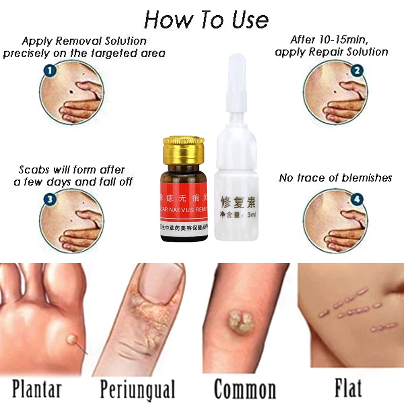 

Wholesale Mole Skin Tag Removal Solution 100% Remover Skin Tags Warts Moles Repair Solution M3