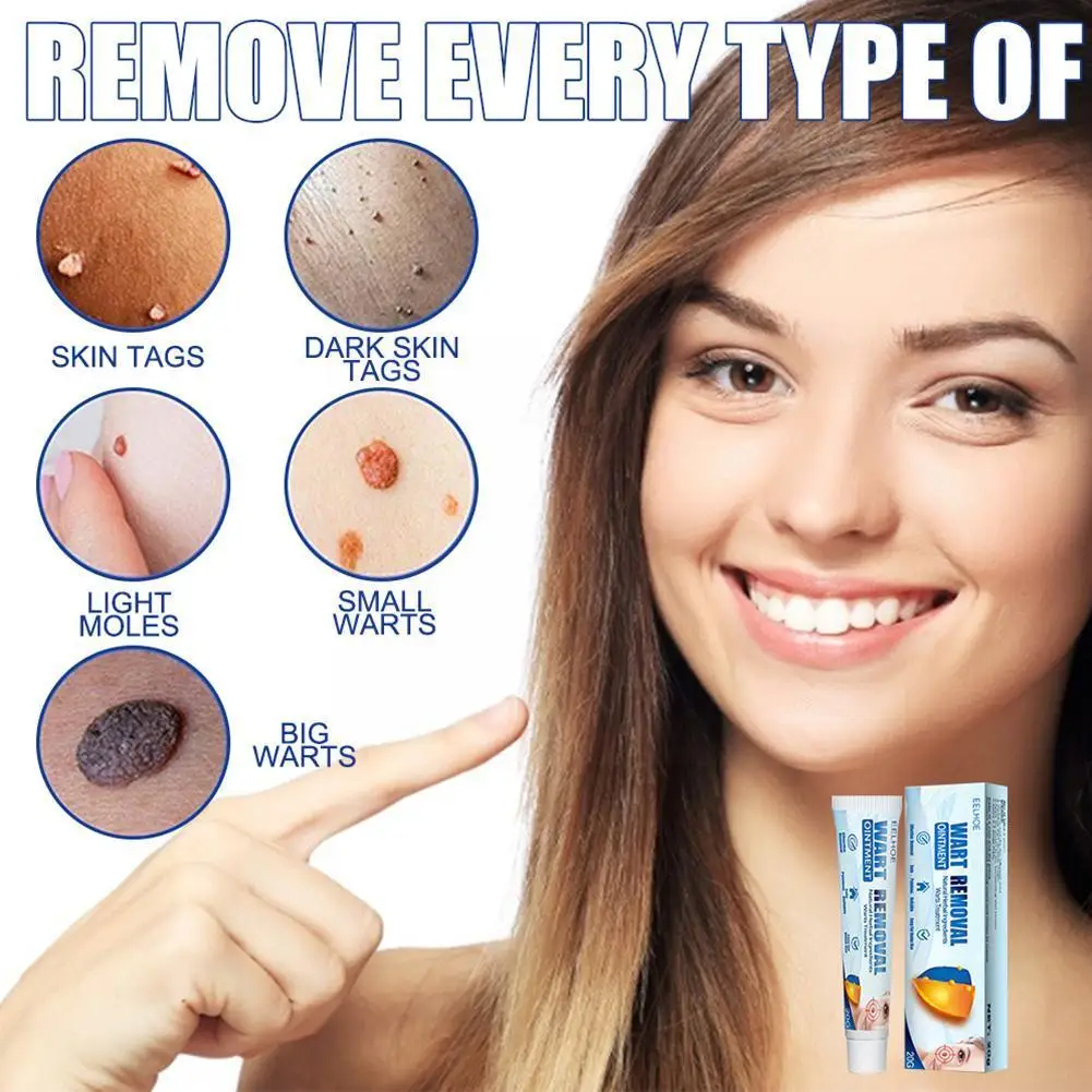 

Wart Cream Skin Tag Remover Antibacterial Cream Micro Ointment Wart Skin Mole Extract Treatment Ointment Body Herbal Effect F8I1