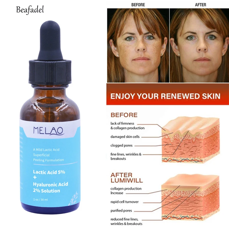 

Lactic Acid Skin Peel For Face Acne Wrinkles Melasma Age Spots Brightening Exfloliating Relieving Serum Skin Care