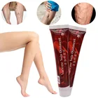 Крем для лечения варикозного расширения вен, васкулит, флебит, раньше, удаление варикозного расширения вен, ангиит, 100% оригинал, травяной