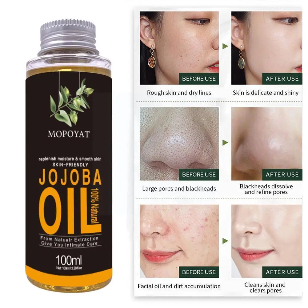 

Jojoba Oil 100% Pure & Cold Pressed, Natural Moisturizer For Face And Hair And Great For All Skin Diys Polishes Masks Body D9x4