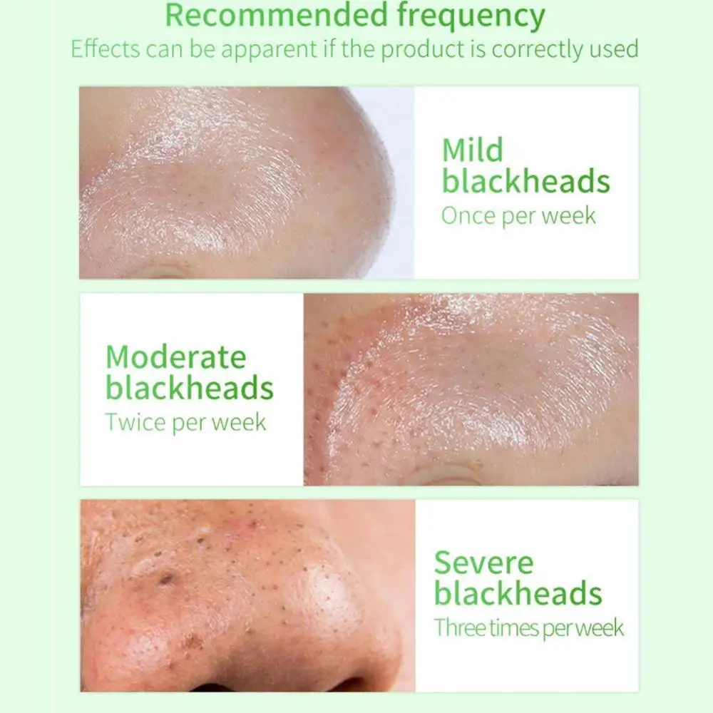 Сыворотка для лица средство удаления угрей маска уменьшения пор лечение акне