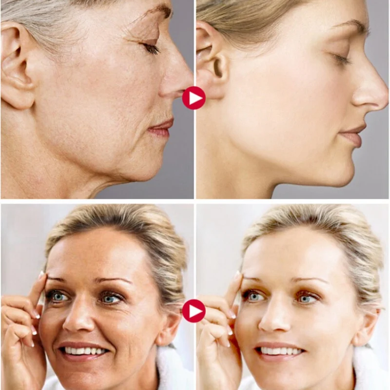 Anti Aging Face Cream Anti Wrinkle Acne Pimple Spot Resveratrol Whitening Moisturizing Facial Cream Beauty Skin Care 20g Q1