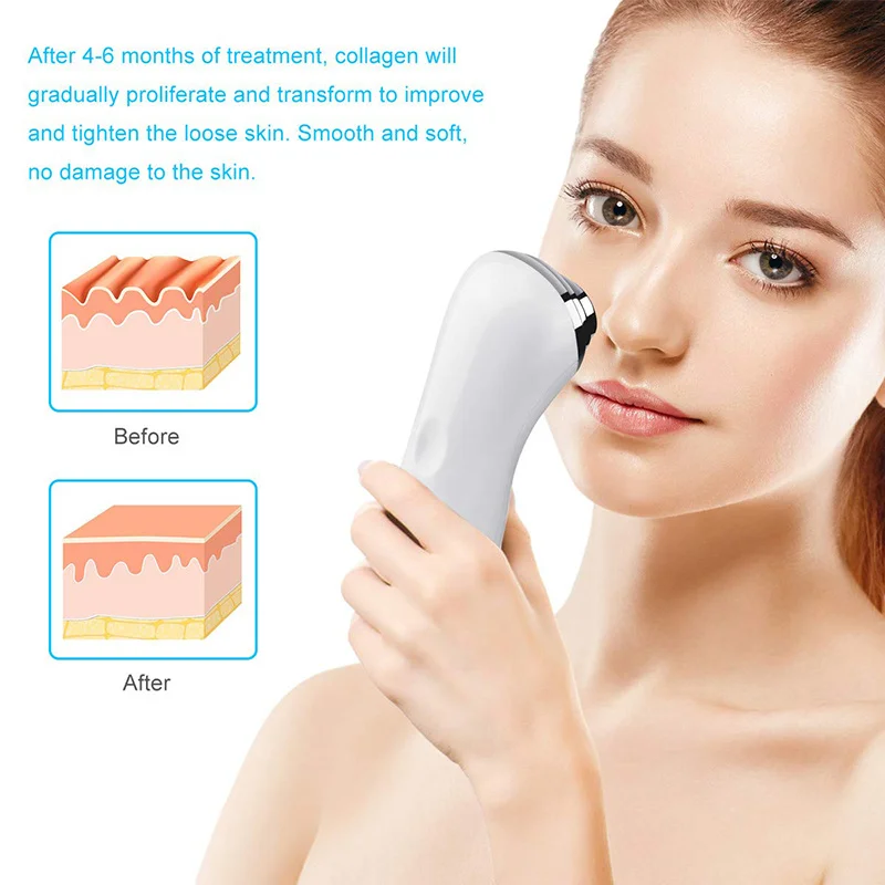 Ультразвуковая мини-машина HIFU раньше против морщин ультразвуковая вибрация