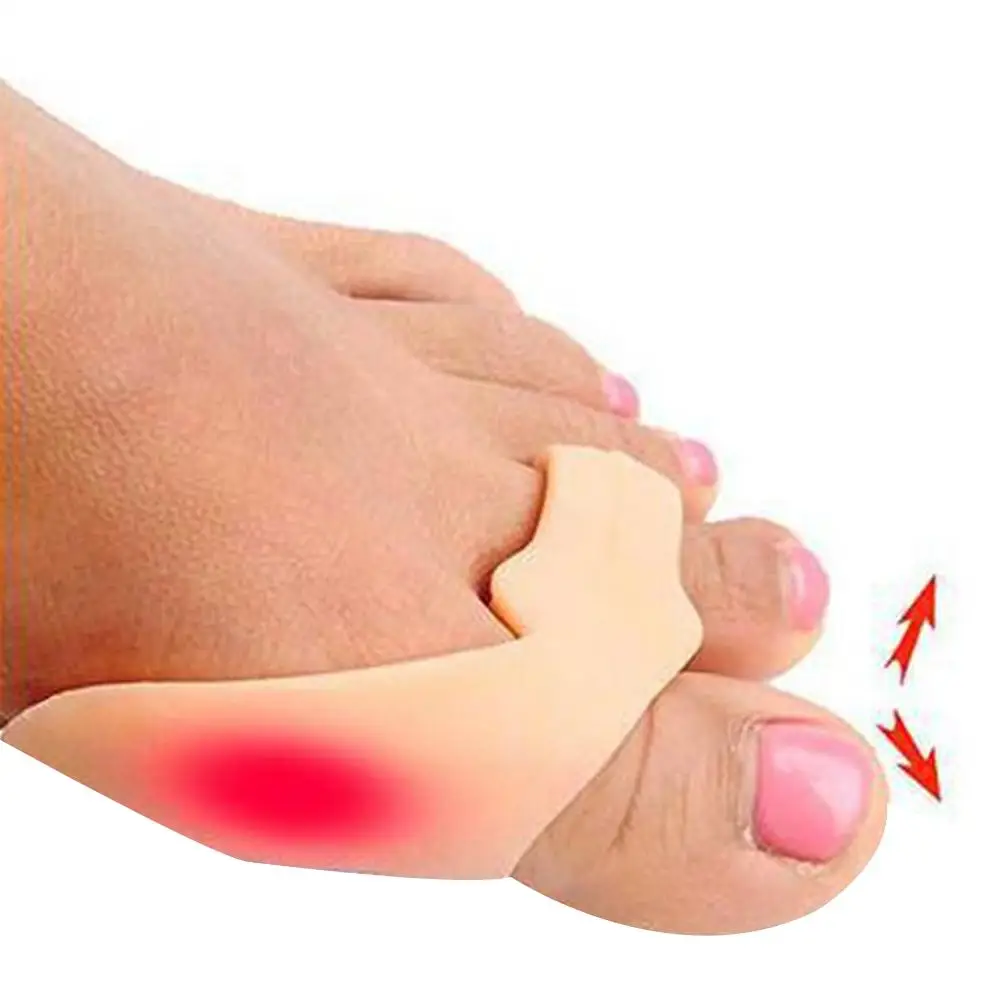 Гель Силиконовый корректор Bunion разделитель большого пальца Hallux Valgus ступни