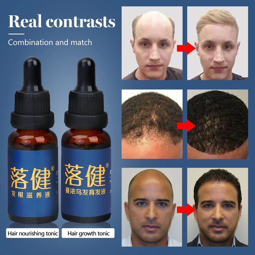 

Hair Growth Essence Anti Hair Loss Fast Growth of Hair Thick Hair Repair Hair Root and Scalp Hair Care Nutrient Solution