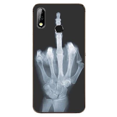 For Meizu M10 Case 6.5'' Fashion silicone Soft TPU Cute Back Cases for Phone Cover Protective Shells Coque | Мобильные