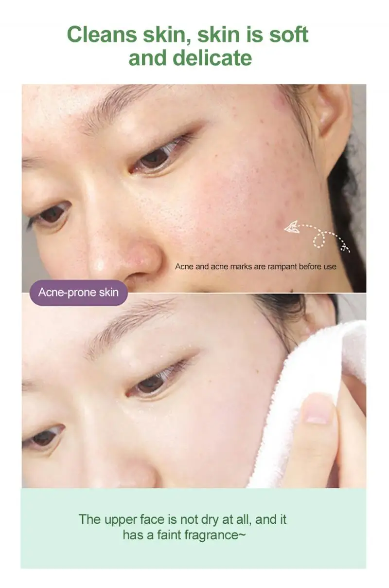 Очищающая маска для лица и носа на основе зеленого чая | Красота здоровье