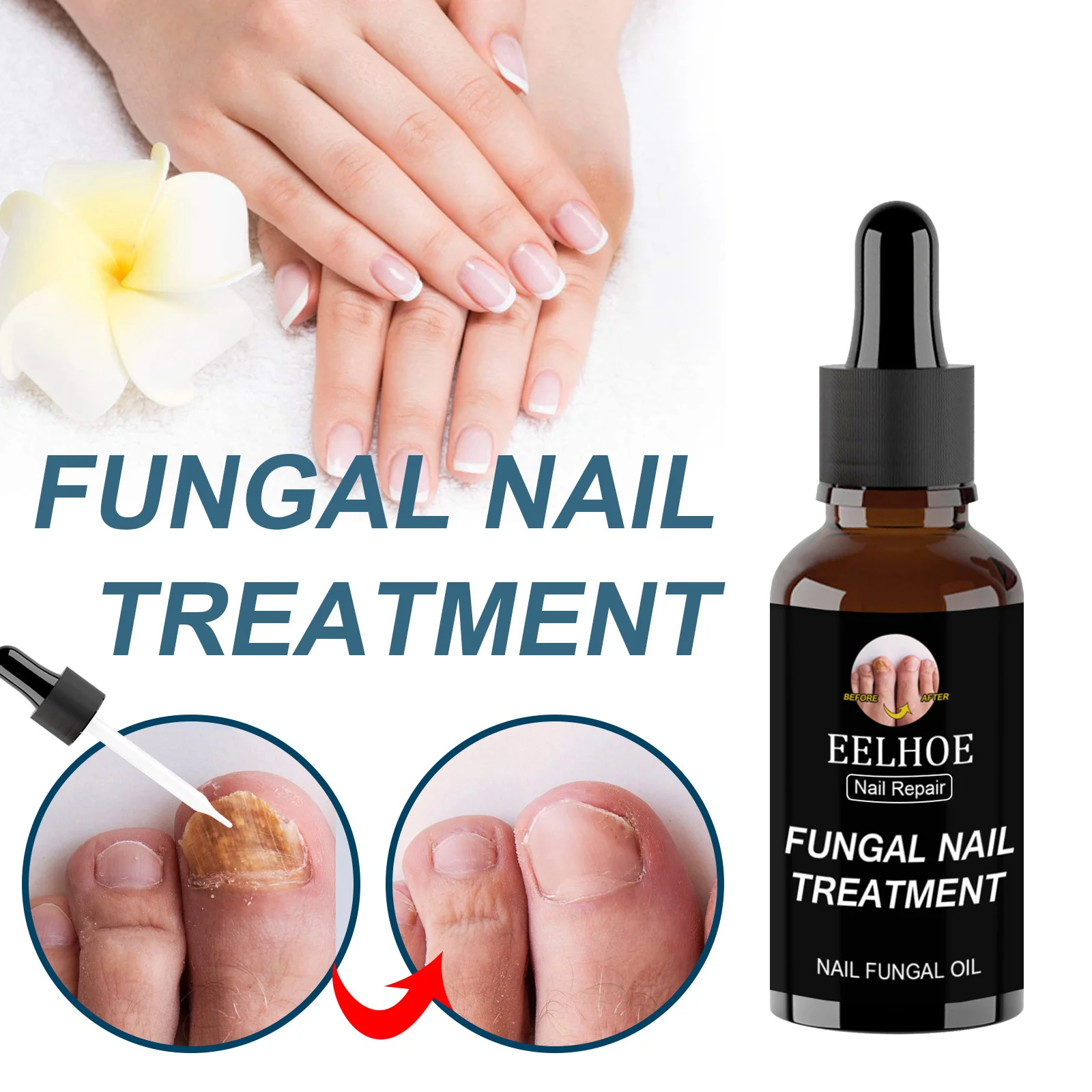 

Fungal Nail Care Essential Oil Fungus Removal Hand And Foot Care Serum Onychomycosis Repair Fluid Anti-Fungal Nail Gel Oil