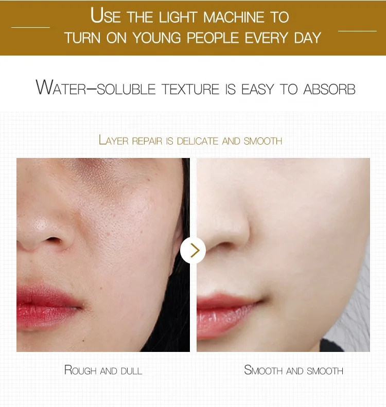 OEM хумаи увлажняющий антивозрастной против морщин устройство для удаления