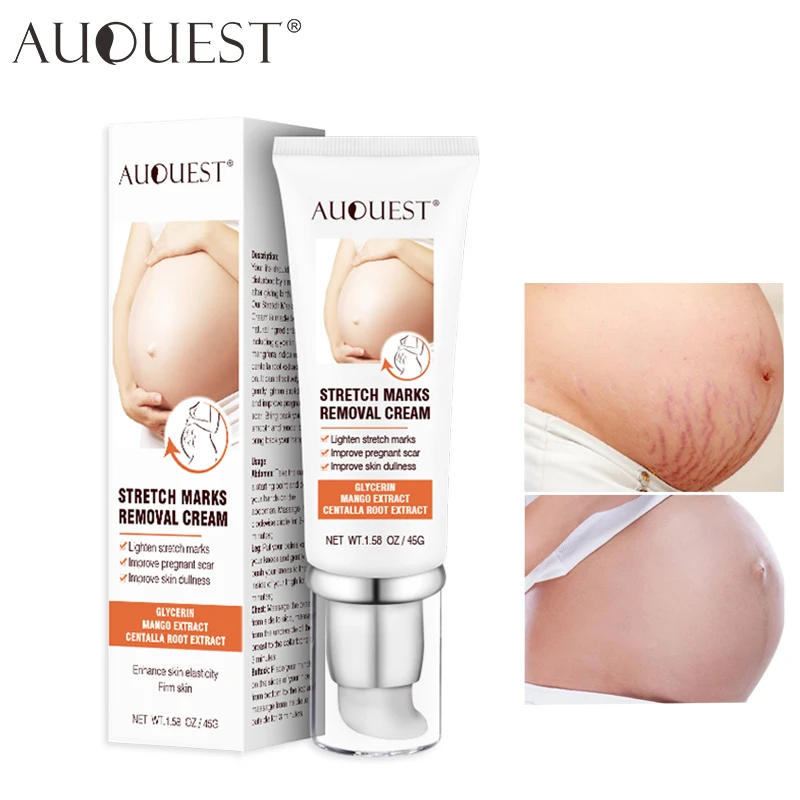 

AUQUEST Stretch Marks Removal Maternity Scar Acne Remover Cream for Pregnant Women Anti-Aging Skin Firming Cream Body Care 45g