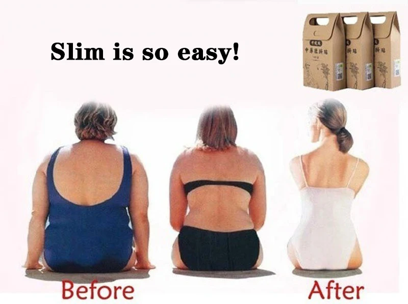 Новинка 10 шт./пакет китайская Кнопка тревожного вызова для диеты похудения патч