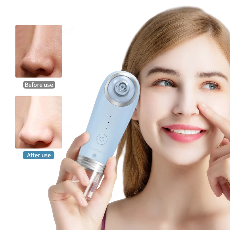 

Blackhead Removal Small Bubble Cleaner Vacuum Suction Water Cycle Acne Pimple Removal Electric Deep Pore Facial Cleaner Tool