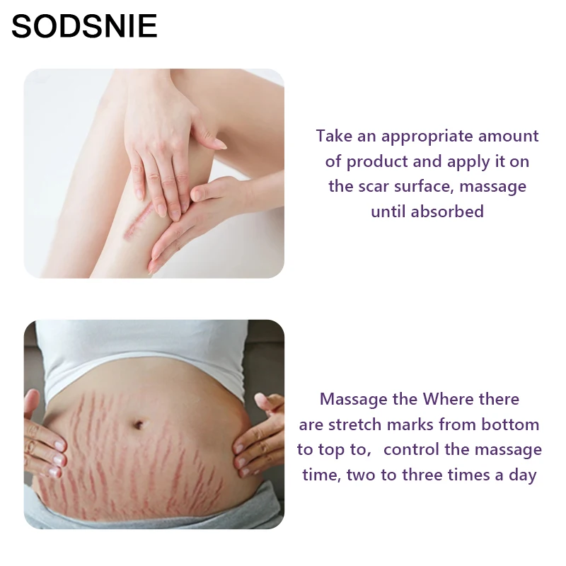 Натуральное масло для лечения кожи беременных женщин и кормящих матерей