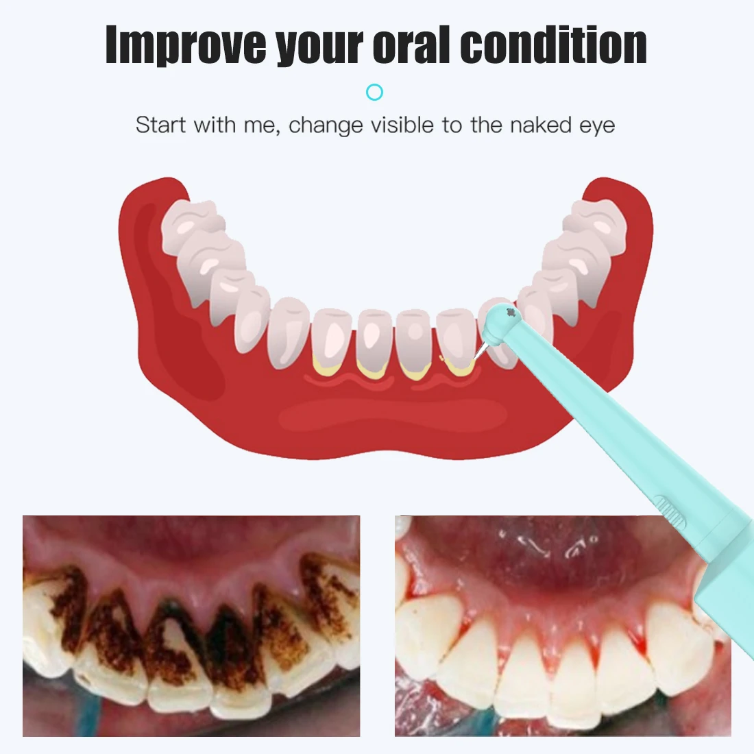 Новинка 2020 Электрический стоматологический скалер водонепроницаемый