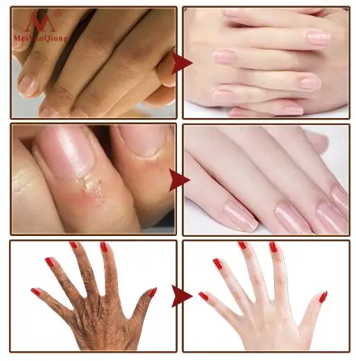 Крем для рук лосьоны сыворотки восстанавливающий питательный крем кожи против