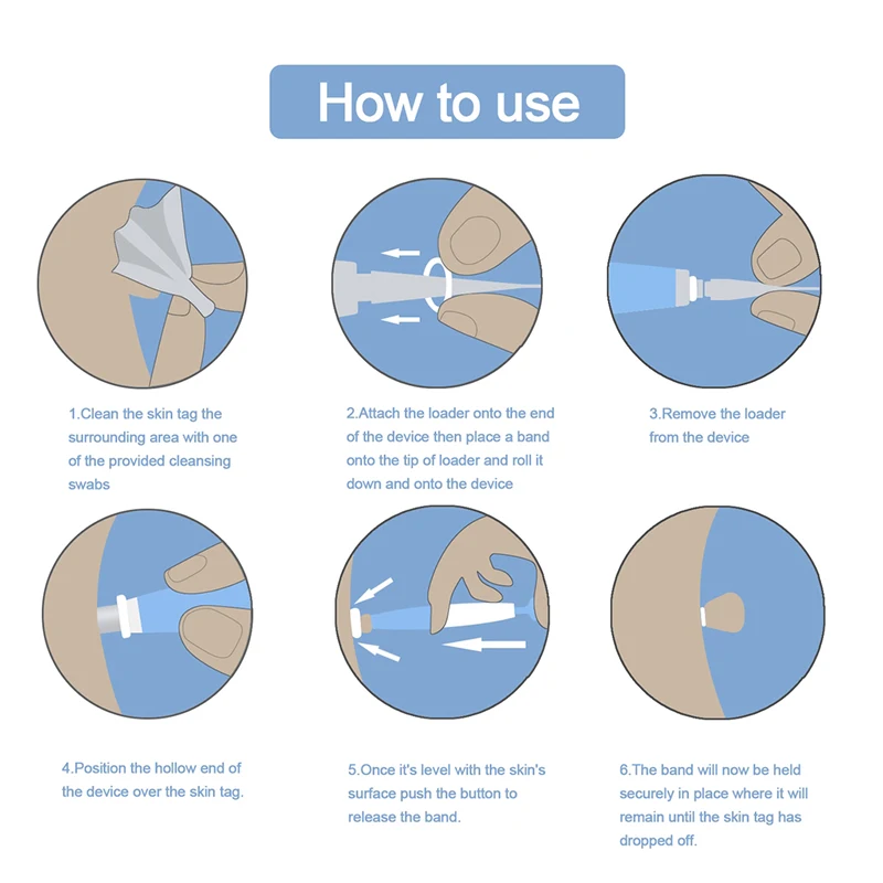 Набор для удаления этикеток на кожу домашнего использования этикетка родинок