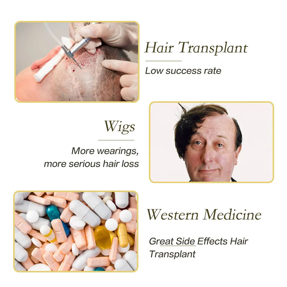 Эссенция для роста волос против выпадения мужчин t эфирное масло жидкий спрей