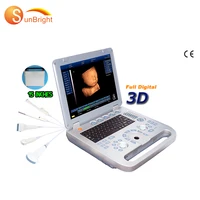 3d 4d full digital medical doppler ultrasound cheap medical ultrasound instruments sunbright