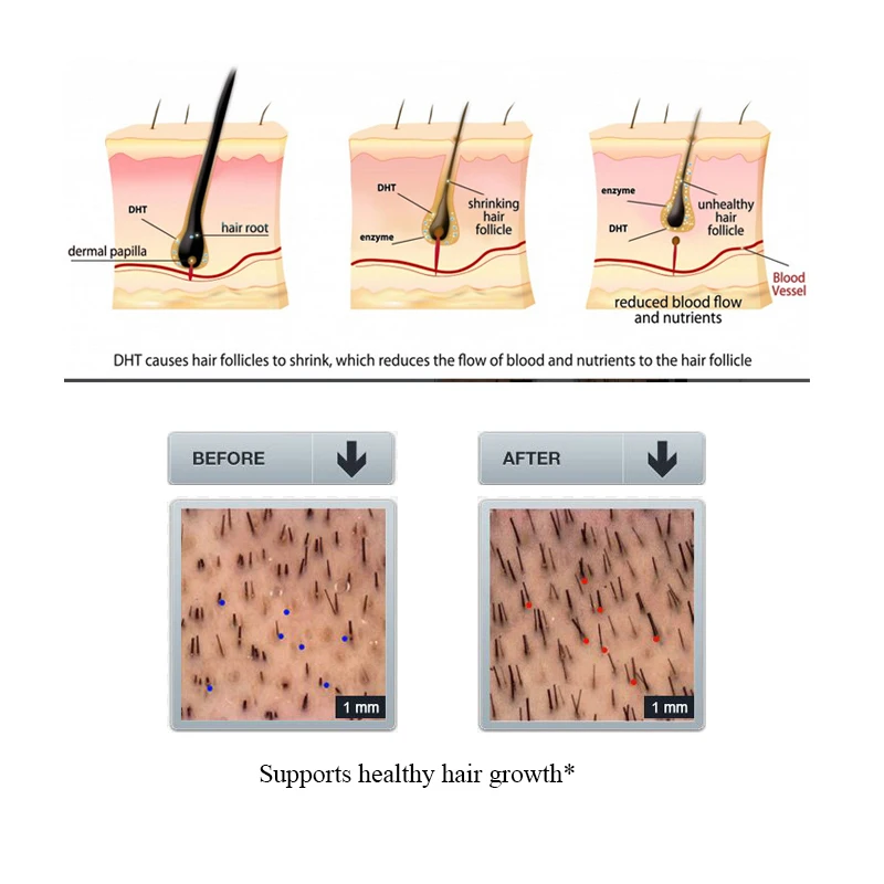 

5pcs/Set Natural Ginger Oil Anti Hair Fall Shampoo Thicken Hair Conditioner Anti Hair Loss Essence Growth Hair Scalp Treatment