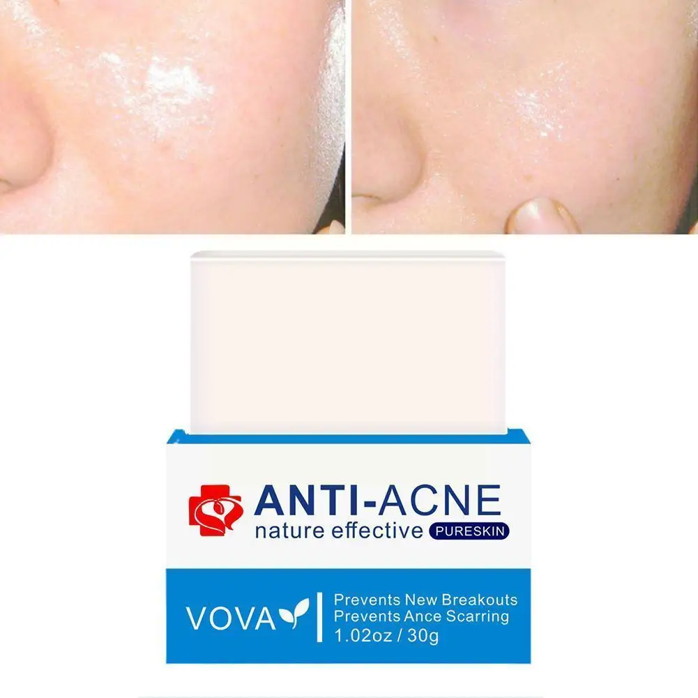 

Anti-acne Face Wash Soap Effectively Clean The Skin Pores Oil Refine Refreshing Moisturizing Skin The Care Long-lasting Con S6w1