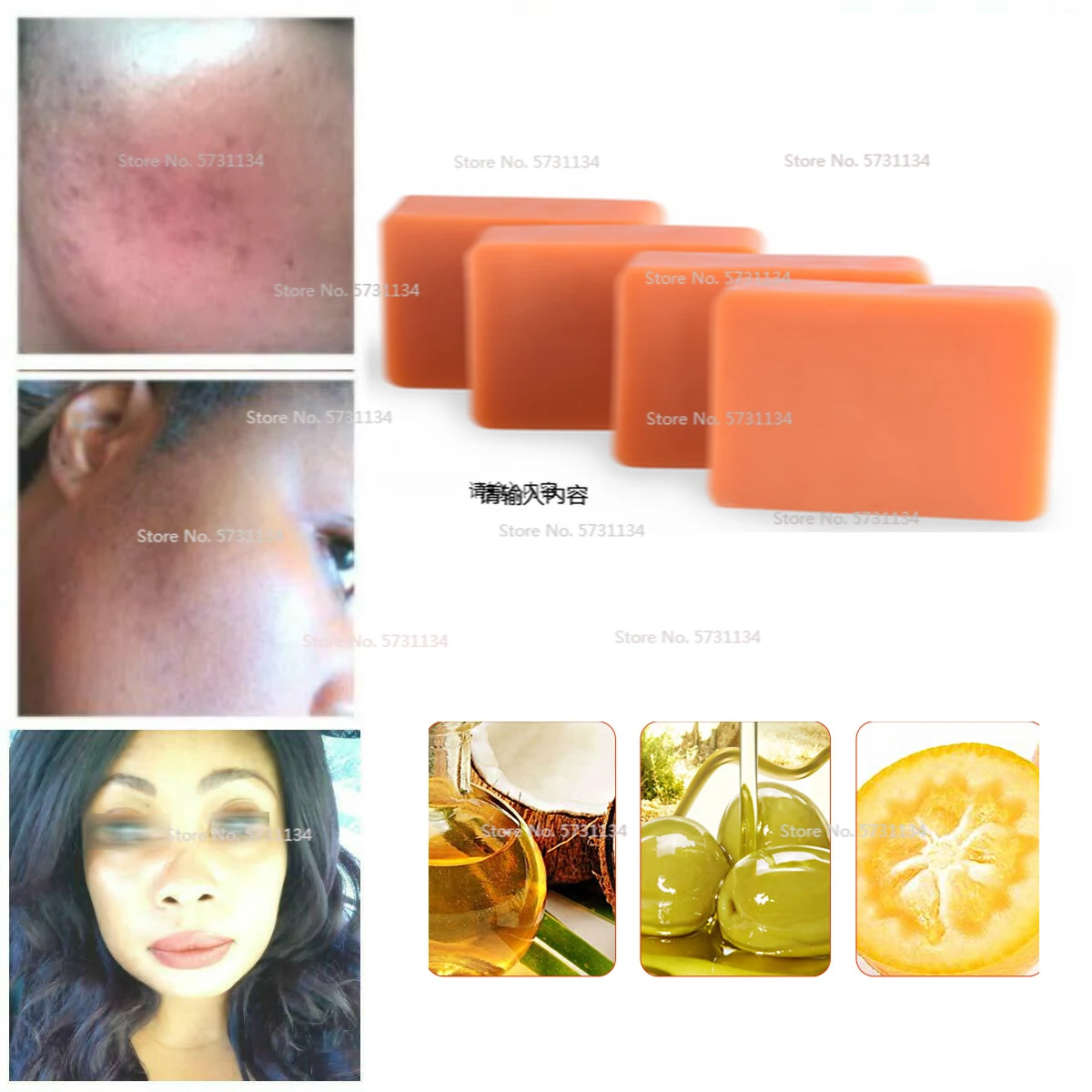 Kojic Acid Soap Brightening Lightening Papaya, 4%Kojic Acid,Glutathione,Turmeric kojic acid and its derivatives