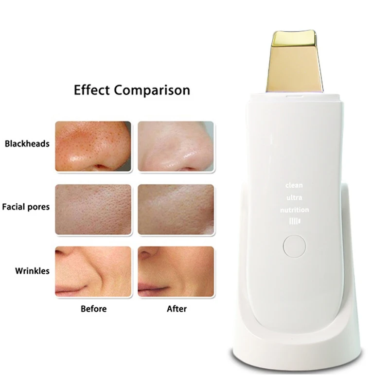 Ультразвуковой скребок для кожи лица Ион Глубокая чистка пилинг удаления угрей