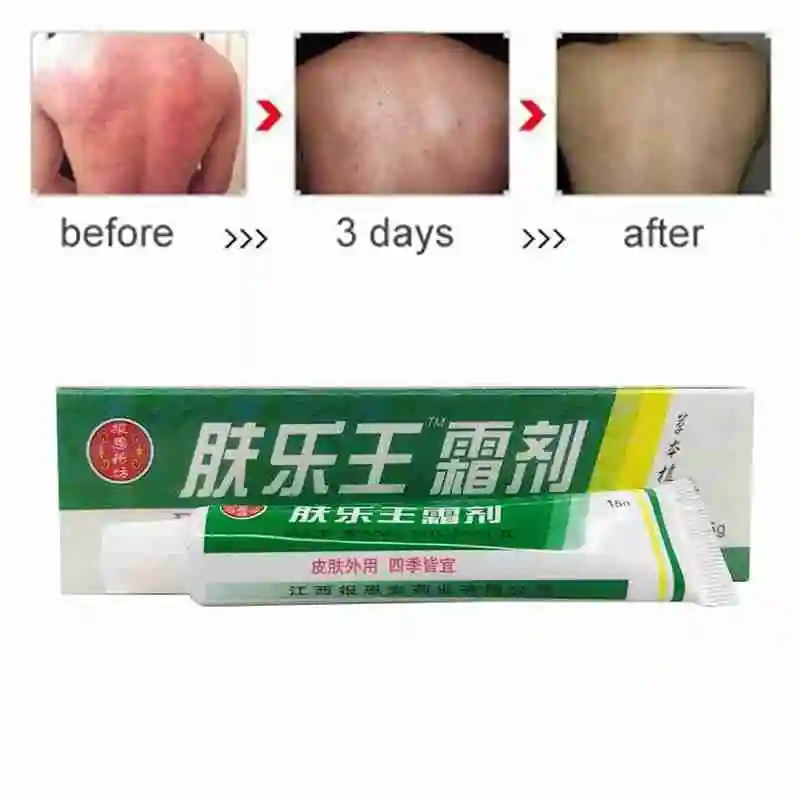 Крем для лечения псориаза дерматита экземы массажный крем 1 шт. |