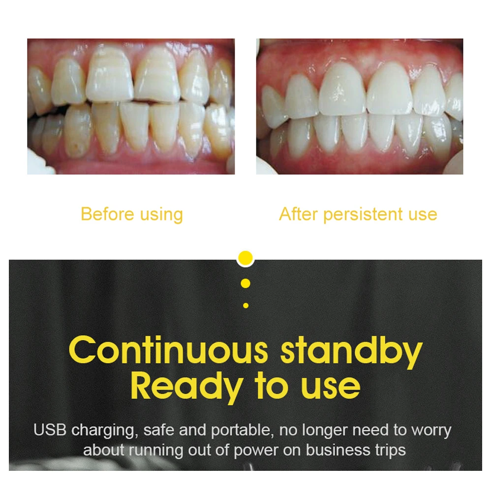 Ультразвуковой очиститель зубов, отбеливание зубов, вибрационный детартеур, уход за полостью рта.