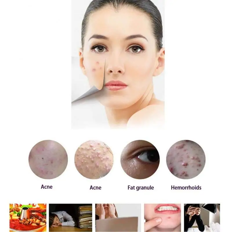 Перезаряжаемый ластик для удаления акне лазерная ручка с сисветильник том