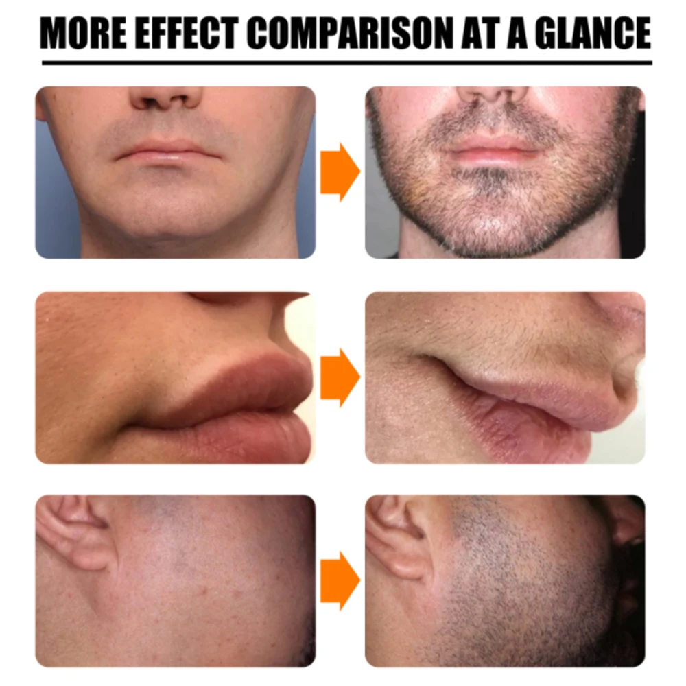 Натуральный мужской ролик для роста бороды мужское масло питательный усилитель