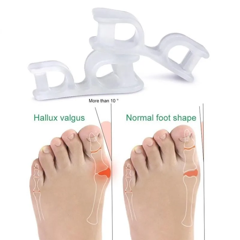 Вальгусный Ортез для большого пальца Bigfoot вальгус палец ноги сепаратор