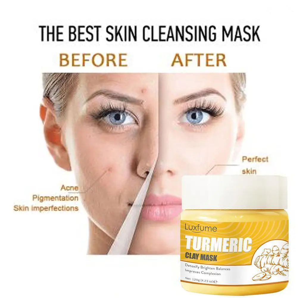 

Turmeric Face Cream Repair Acnes Scar Dark Spot Treatment Moisturizer Skin Acne Care 120g Lightening Against Whitening T7U0