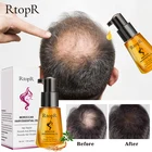 Марокканский продукт для предотвращения выпадения волос, эфирное масло для роста волос Удобный для переноски Уход за волосами, уход за волосами, 35 мл масла, подходит для любой кожи