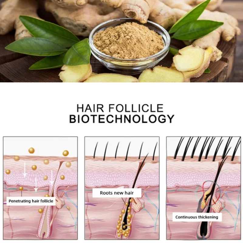 

30ml Anti Hair Loss Essence Repair Damage Hair Growth Treatment Thick Root Repair Dry Hair Care Hair Growth Essential Oil New