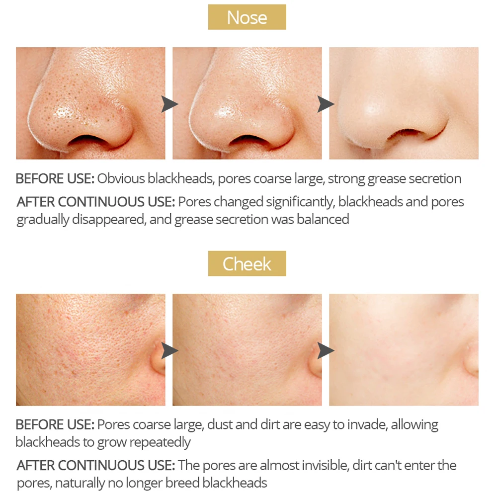 Яркий гламурный счастливый пакет из 3 предметов набор для удаления черных точек