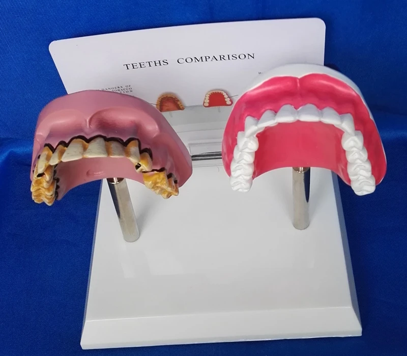 Модель зуба для кормления медицинская модель ухода за зубами обучения курению