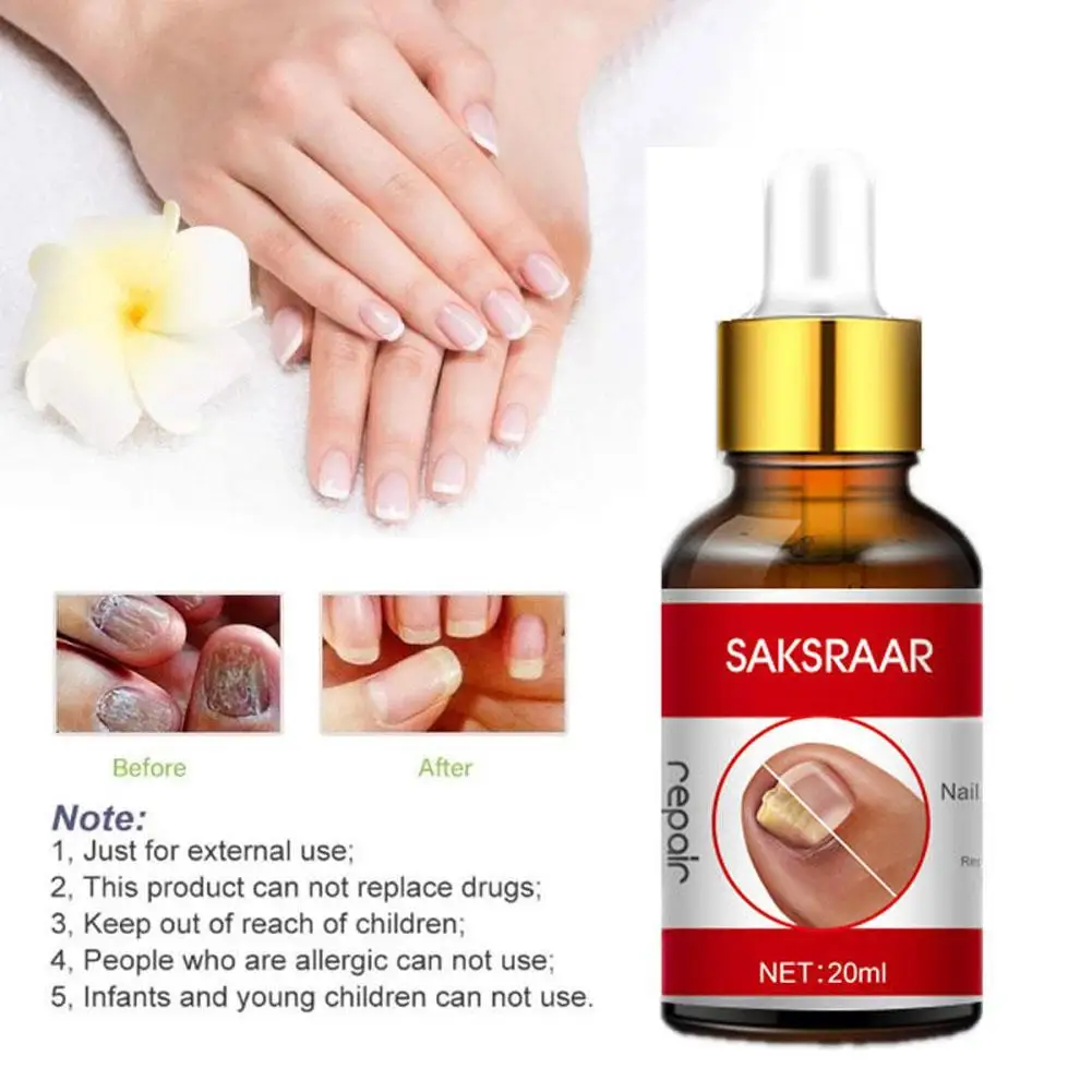 

Fungus Nail Care Essential Oil Nail Problem Treatment Of Onychomycosis Anti Fungus Atrophy Herbal Extracts Repair Nail Care Oil