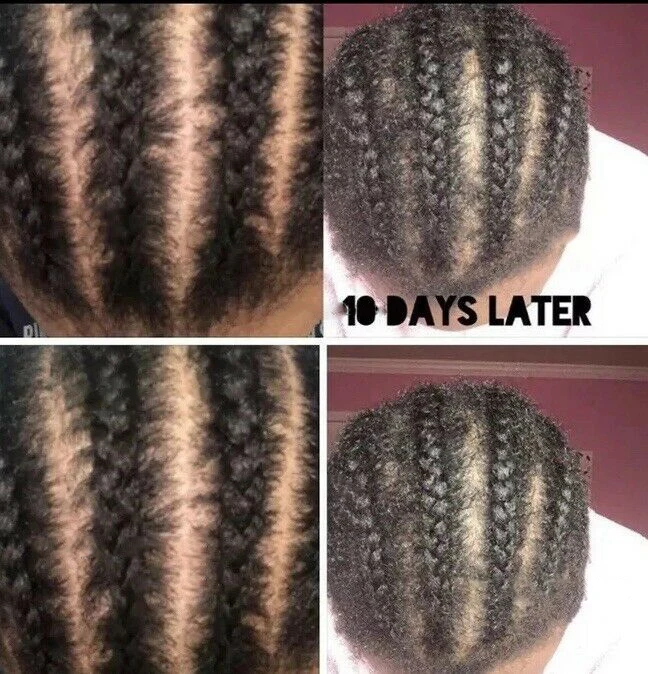 

Anti-itch hair Growth Braid Oil, Itchy scalp, 30 ML
