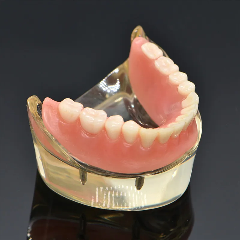 

Модель зубной нижней челюсти, модель имплантата, съемные зубы, с 4 винтами для имплантата, модель для обучения и ремонта