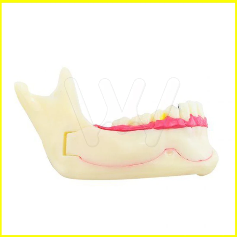 Стоматологическая мандибуларзубы демонстрация анатомическая модель обучения