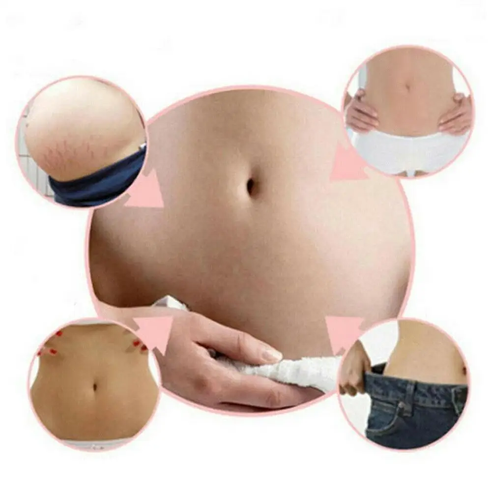 

20g Powerful Remove Pregnancy Scars Cream Stretch Marks Creams Treatment Repair Winkles Firming Body Maternity Anti S9L6