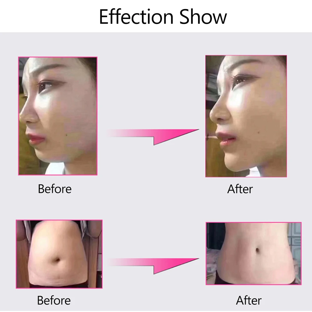 2019 Korea High Pressure No Needle Hyaluronic Acid Lip Lifting Serum Pen Injection Mesotherapy Gun For Anti-Wrinkle | Красота и