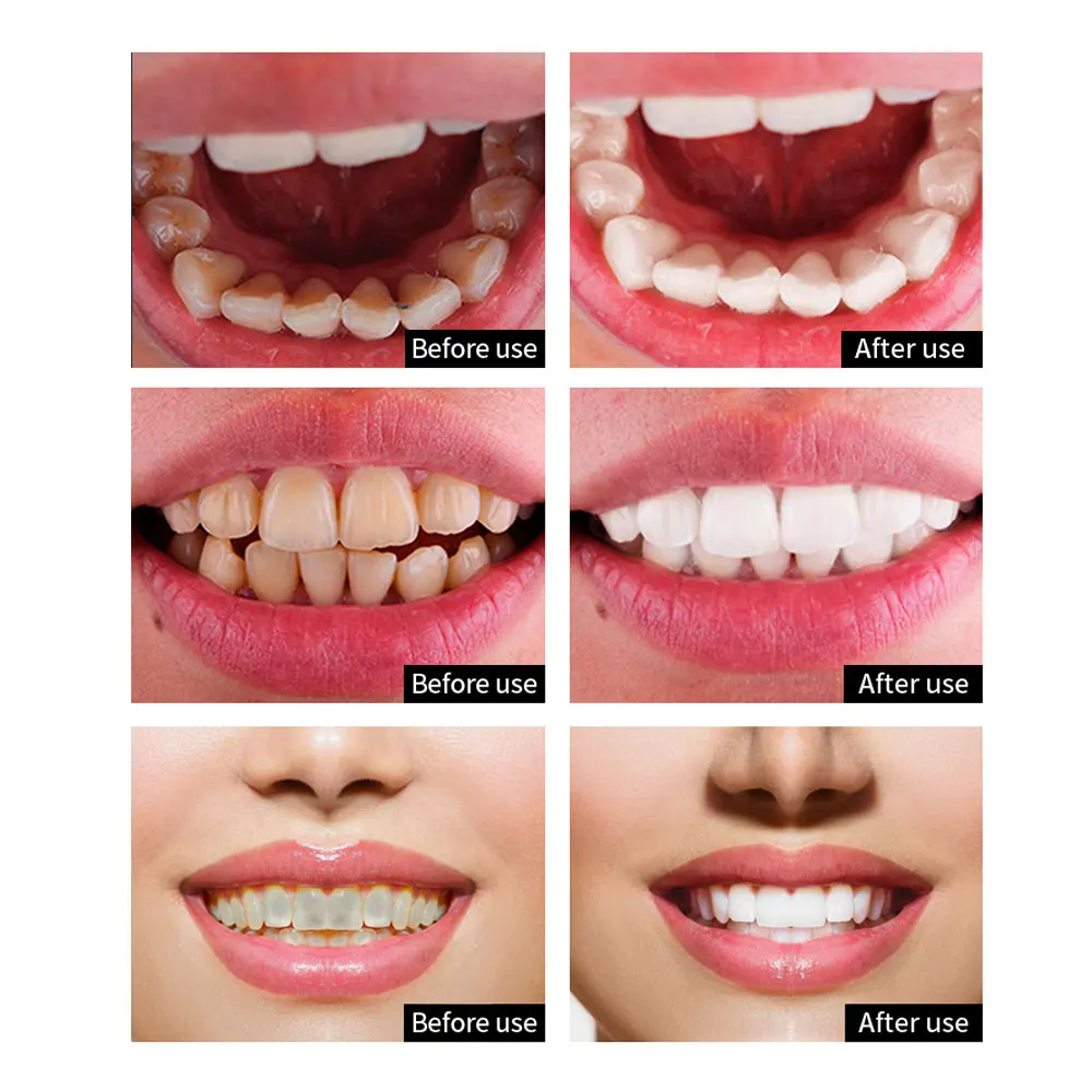 ARTISCARE для чистки зубов 2 шт. гигиены полости рта отбеливание ярче смена удаление