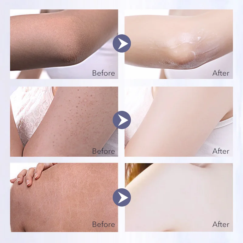 Daralis 280 мл отбеливающий крем для тела глубокое увлажнение омолаживающий